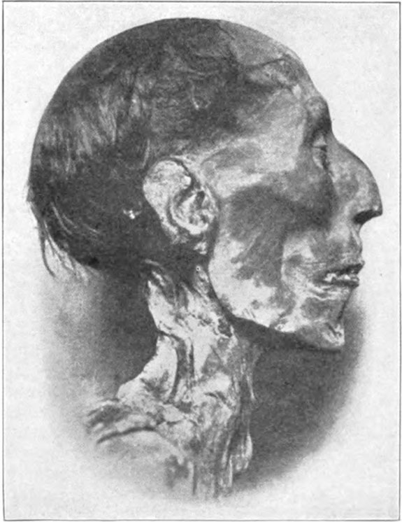Kopf der Mumie Ramses’ II.
